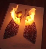 Płuca w trakcie zapalenia